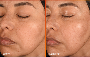 Pb Dermalogica